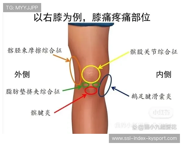 跑步膝的预防：跑姿与肌力平衡，跑步膝治疗方法